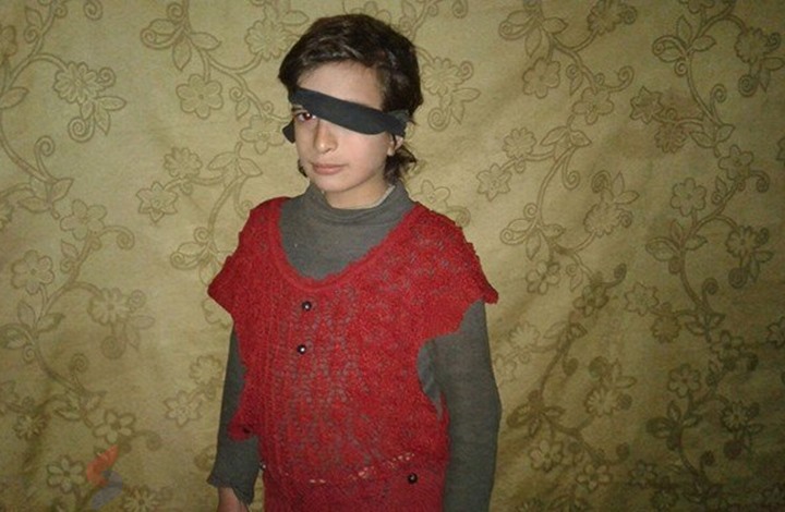 الطفلة السورية حلا
