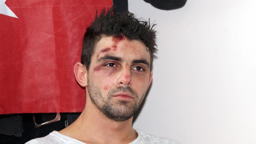 مواطن تركي يؤكد تعرضه للضرب على يد الشرطة الهولندية وعضّ الكلاب