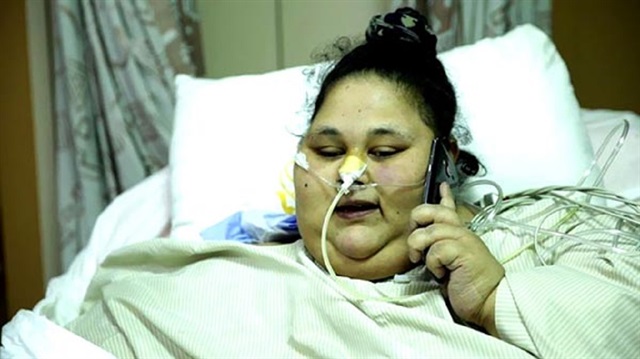 شاهد بالصور.. آخر التطورات في حالة الفتاة المصرية التي تزن نصف طن بعد العملية الجراحية