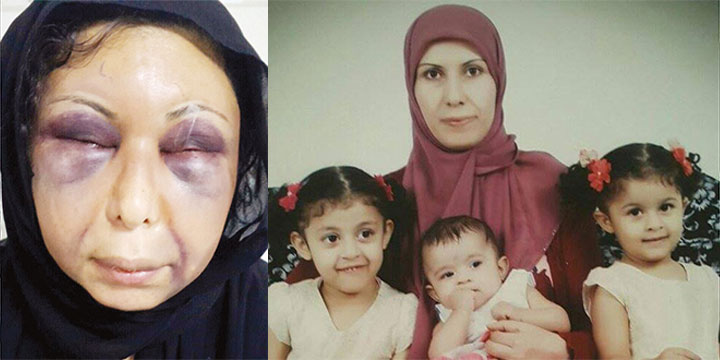شاهد بالفيديو .. بحريني يعذب طليقته السورية بطريقة وحشية ويتسبب إصابات بليغة في الوجه