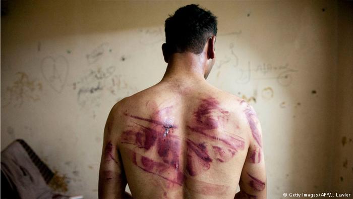 العفو الدولية: لاجئون سوريون يتعرضون للتعـ.ـذيب والاغتصـ.ـاب بعد عودتهم