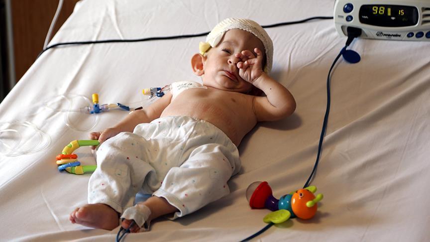 أطباء أتراك ينجحون في إجراء عملية خطيرة لرضيع سوري يعاني من تشوه في الجمجمة