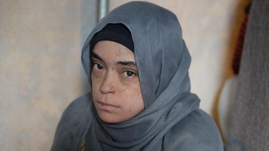الطوارئ التركية تستجيب لاستغاثة فتاة سورية وتعالجها من مرض جلدي