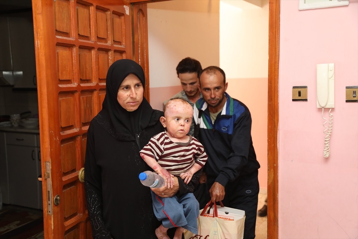 تركيا تحضر طفلًا سوريًا مصابا بـ”الفقاع” لتلقي العلاج (صور مؤلمة)