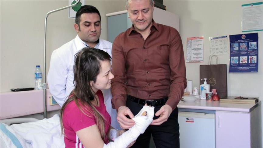 أطباء أتراك ينحجون في صناعة أصبع يد طبيعية لشرطية ألبانية