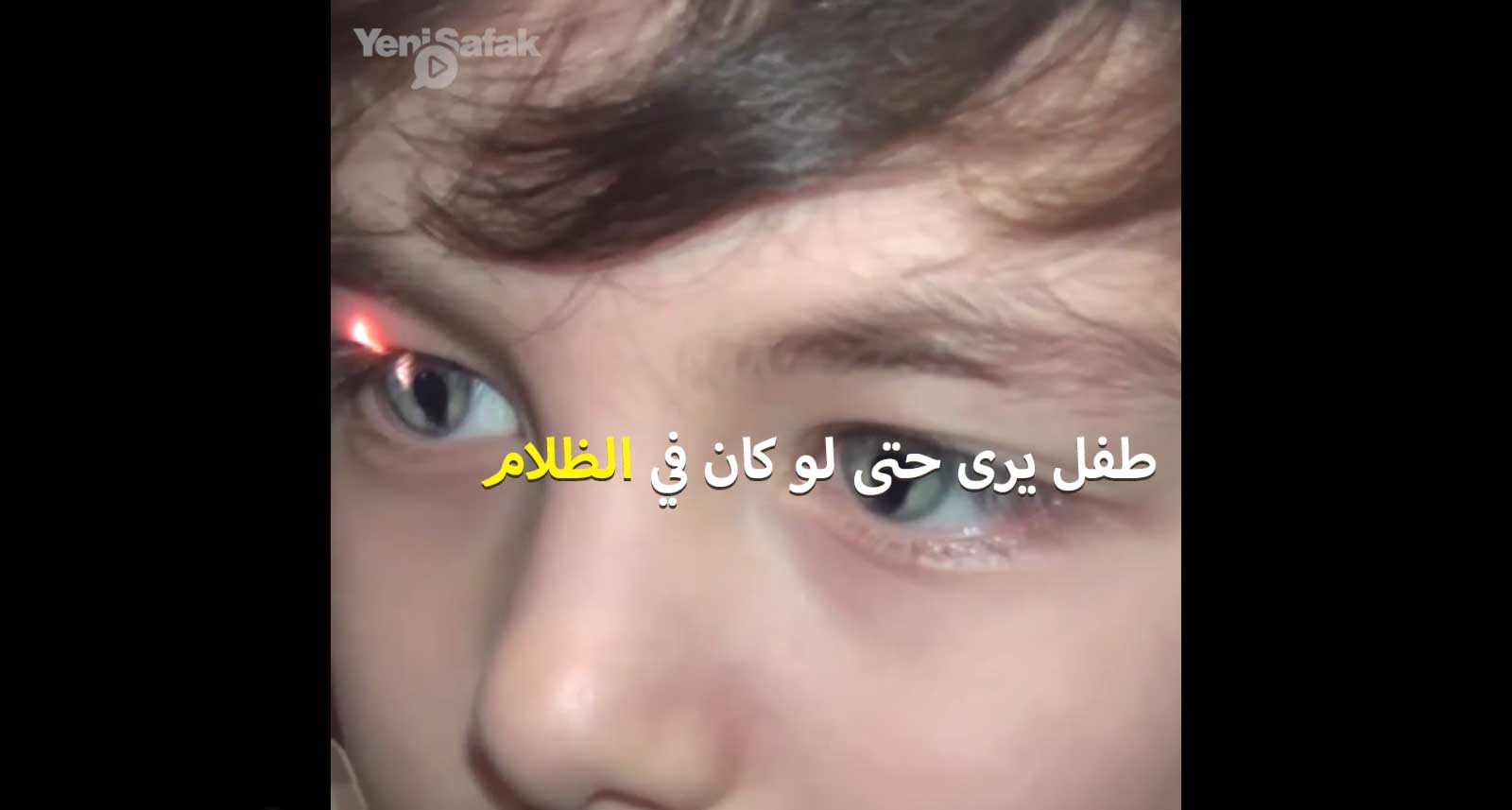 طفل تركي يحيّر الأطباء بقدرته النادرة هل الرؤية في الظلام (شاهد)