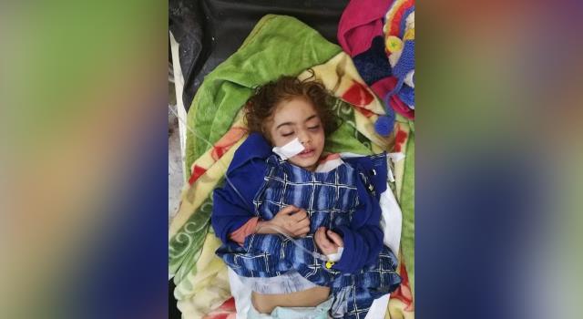 وفاة طفلة عراقية إثر تعذيب زوجة أبيها لها: كيّ بالنار وصعق بالكهرباء