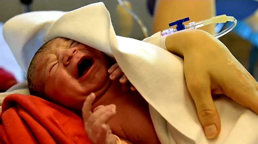 أطباء: “نادرة جدا”… ولادة طفل بعين واحدة في مصر تثير ضجة (صورة)