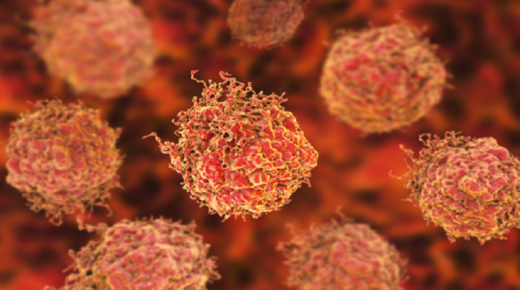 علماء أتراك يطوّرون علاجاً جديداً لمرض السرطان.. هل ينتهي عصر الكيماوي؟