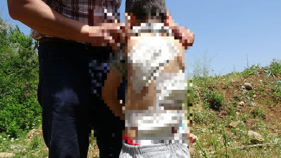 تركيا: كان يقدم لهم الطعام.. قطيع كلاب ضالة يهـ.ـ اجم طفل بعمر 5 سنوات ويتسبب له بضرر كبير