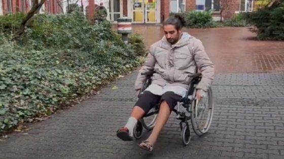 شاب دخل مستشفى في ألمانيا لعلاج قدمه اليسرى فأجروا له جراحة على اليمنى
