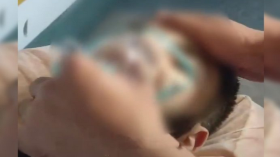 تداول مقطع فيديو مؤثر لشاب سوري وهو يلفظ أنفاسه الأخيرة (فيديو)