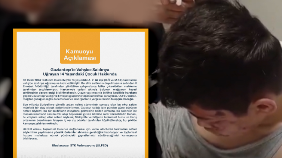 إدانات سورية وتركية لتعذيب طفل سوري